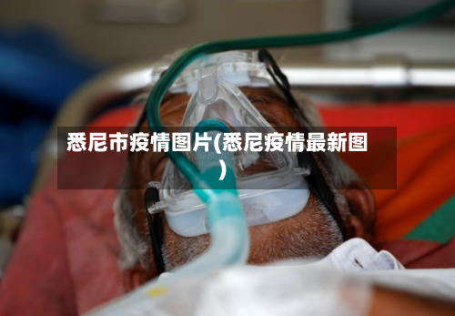 悉尼市疫情图片(悉尼疫情最新图)-第1张图片