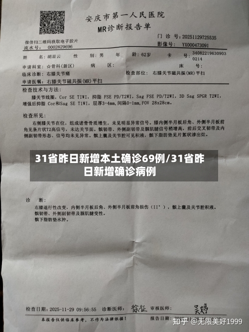 31省昨日新增本土确诊69例/31省昨日新增确诊病例-第2张图片
