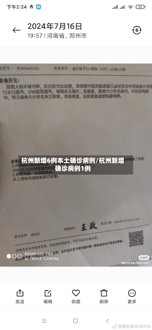 杭州新增6例本土确诊病例/杭州新增确诊病例1例-第2张图片