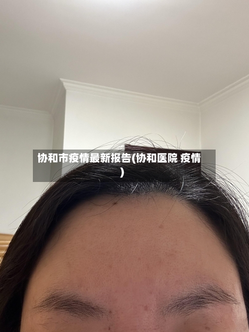 协和市疫情最新报告(协和医院 疫情)-第1张图片