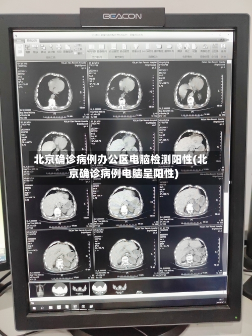 北京确诊病例办公区电脑检测阳性(北京确诊病例电脑呈阳性)-第1张图片