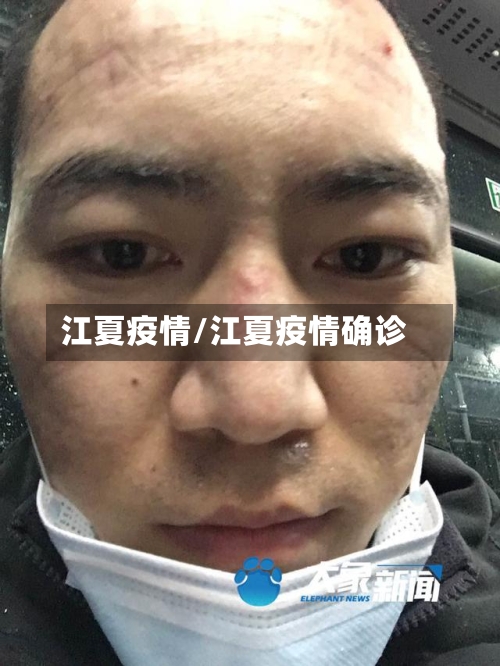 江夏疫情/江夏疫情确诊-第2张图片