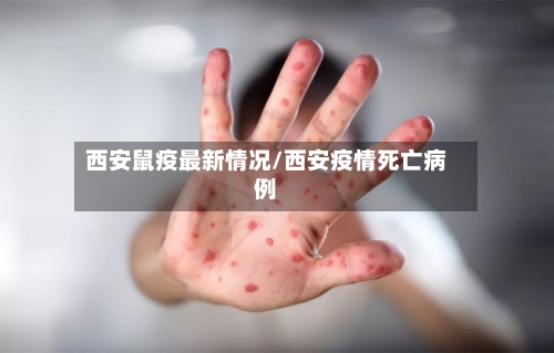 西安鼠疫最新情况/西安疫情死亡病例-第1张图片