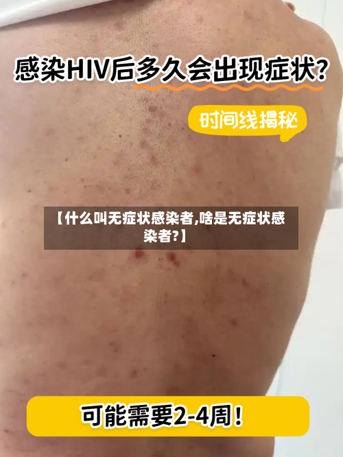 【什么叫无症状感染者,啥是无症状感染者?】-第2张图片