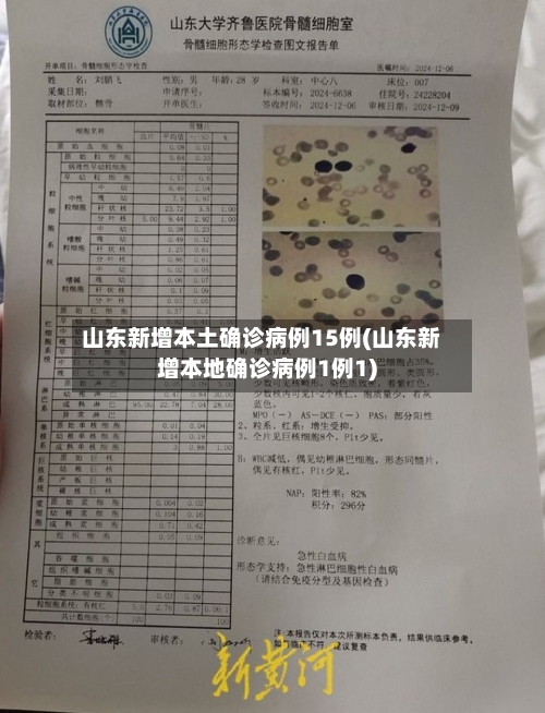 山东新增本土确诊病例15例(山东新增本地确诊病例1例1)-第2张图片