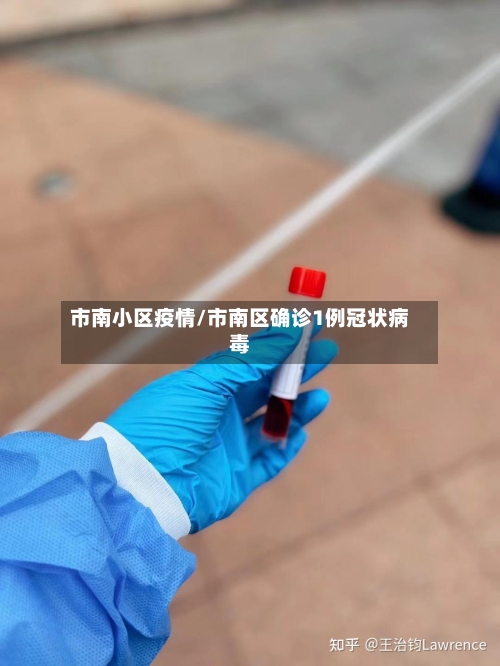 市南小区疫情/市南区确诊1例冠状病毒-第1张图片