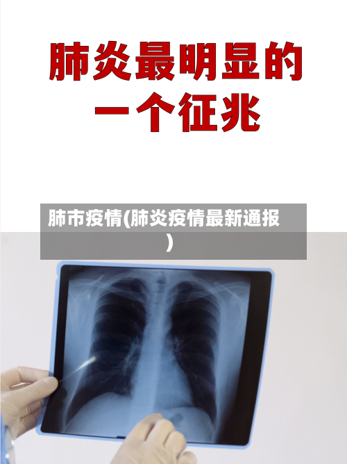 肺市疫情(肺炎疫情最新通报)-第2张图片