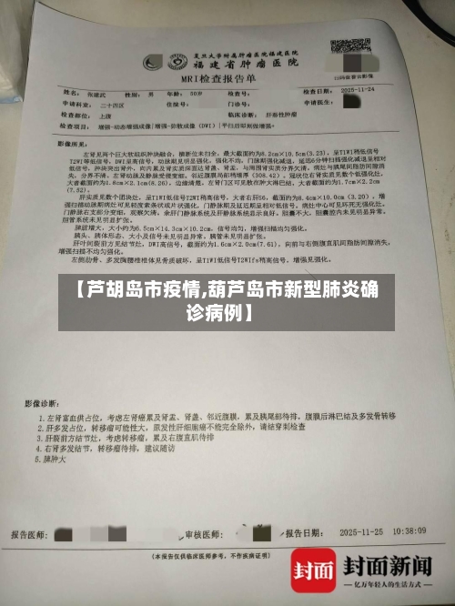 【芦胡岛市疫情,葫芦岛市新型肺炎确诊病例】-第3张图片