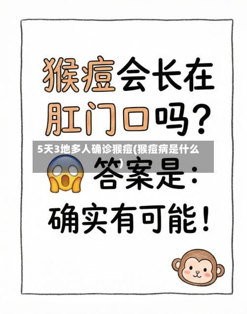 5天3地多人确诊猴痘(猴痘病是什么)-第1张图片