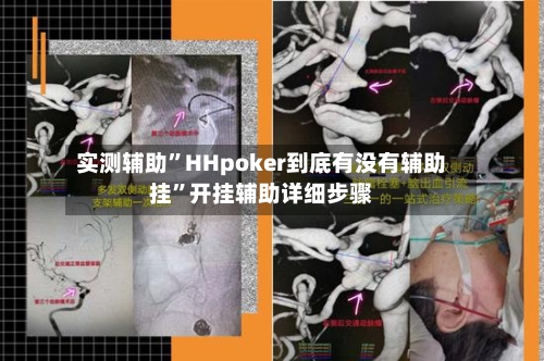 实测辅助	”HHpoker到底有没有辅助挂”开挂辅助详细步骤-第1张图片