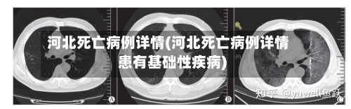 河北死亡病例详情(河北死亡病例详情患有基础性疾病)-第1张图片