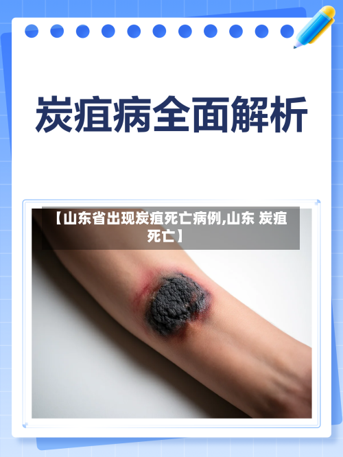 【山东省出现炭疽死亡病例,山东 炭疽死亡】-第1张图片