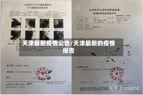 天津最新疫情公告/天津最新的疫情报告-第2张图片