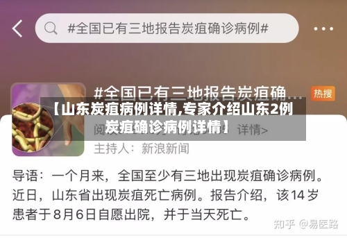 【山东炭疽病例详情,专家介绍山东2例炭疽确诊病例详情】-第1张图片
