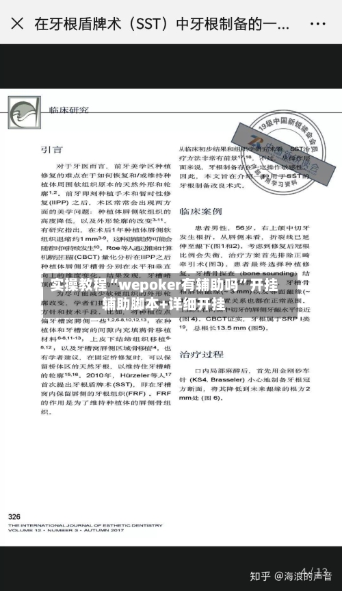 实操教程“wepoker有辅助吗	”开挂辅助脚本+详细开挂-第2张图片