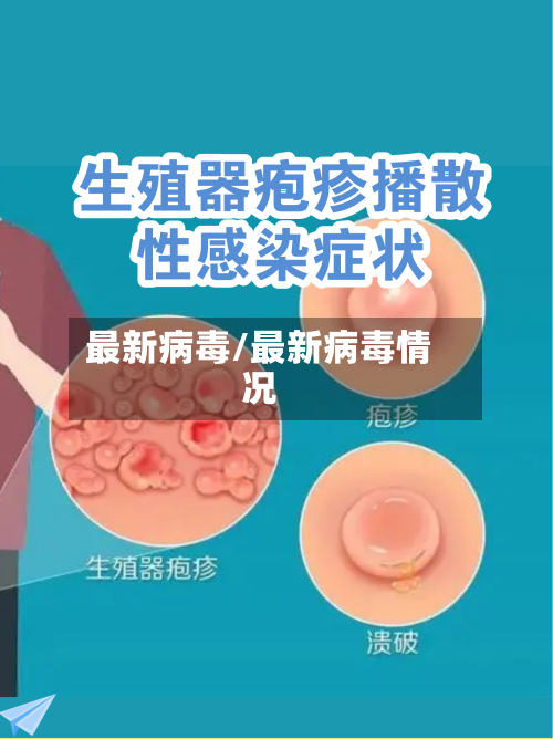 最新病毒/最新病毒情况-第2张图片