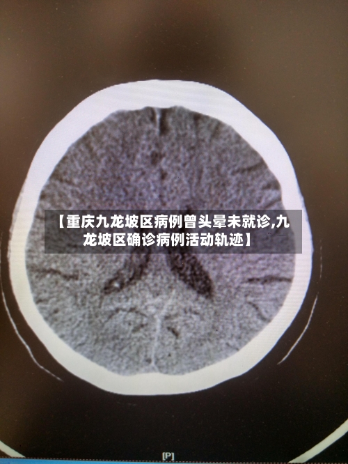 【重庆九龙坡区病例曾头晕未就诊,九龙坡区确诊病例活动轨迹】-第2张图片