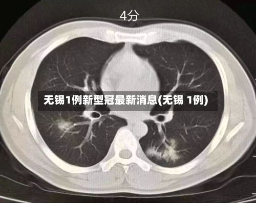 无锡1例新型冠最新消息(无锡 1例)-第2张图片