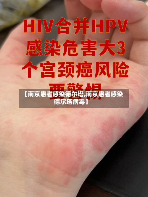 【南京患者感染德尔塔,南京患者感染德尔塔病毒】-第1张图片