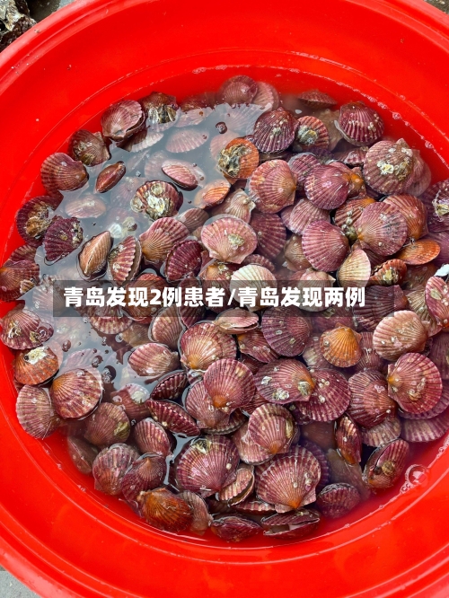 青岛发现2例患者/青岛发现两例-第1张图片