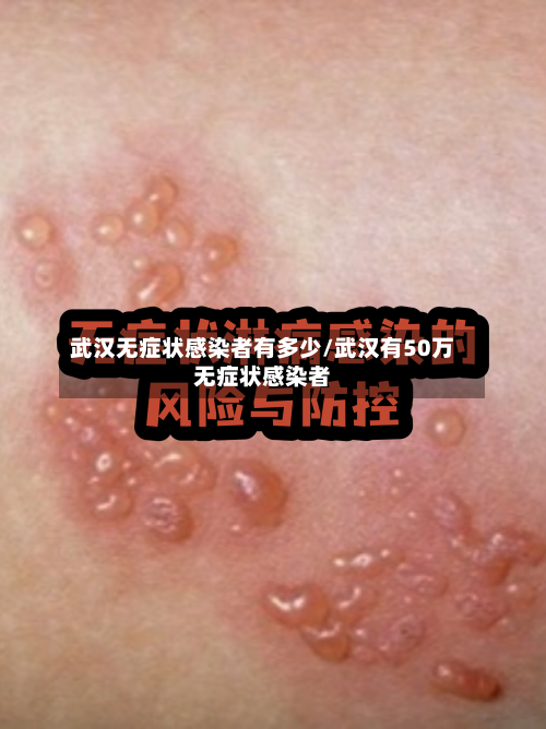 武汉无症状感染者有多少/武汉有50万无症状感染者-第2张图片