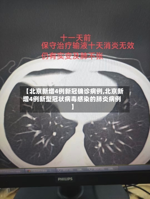 【北京新增4例新冠确诊病例,北京新增4例新型冠状病毒感染的肺炎病例】-第2张图片