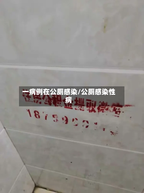 一病例在公厕感染/公厕感染性病-第2张图片