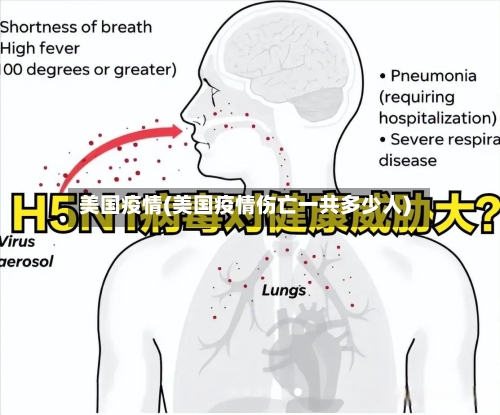 美国疫情(美国疫情伤亡一共多少人)-第1张图片